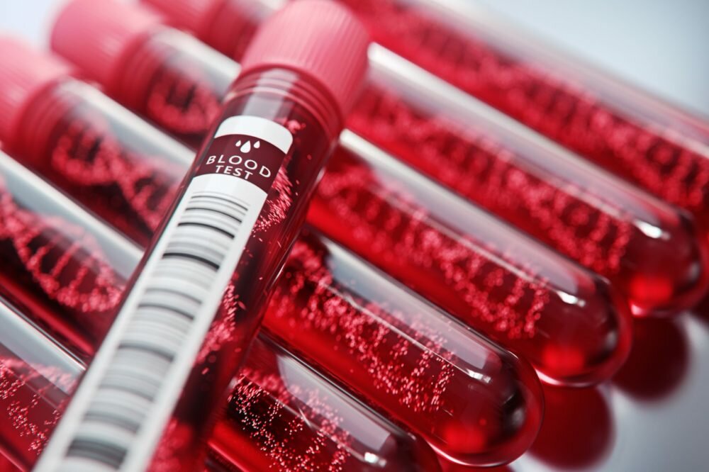 How Well Can a Screening Test Predict Disease Risk How Well Can a Screening Test Predict Disease Risk?